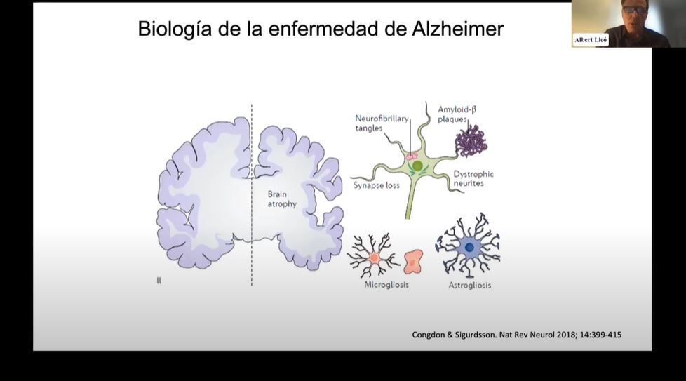 Actualización terapéutica de la enfermedad de Alzheimer - Biología del Alzheimer